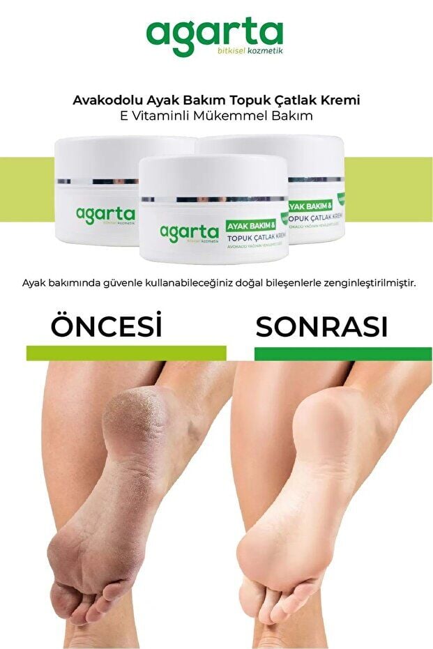 Agarta Ayak ve Topuk Çatlak Bakım Kremi 100ML