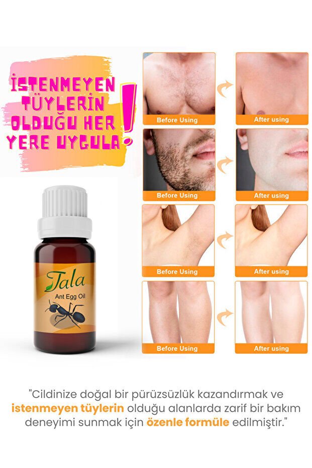 Tala Karınca Yumurtası Yağı Tüy Azaltıcı Tüy İnceltici Tüy Dökücü 20 Ml