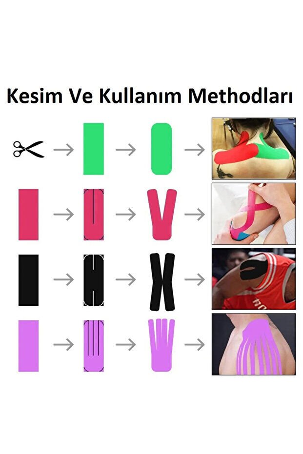 Acura Ac-150 Yüz & Vücut Uyumlu Hipoalerjenik Kinesyo Tape Ağrı Bandı 5m X 5cm Sarı Renk