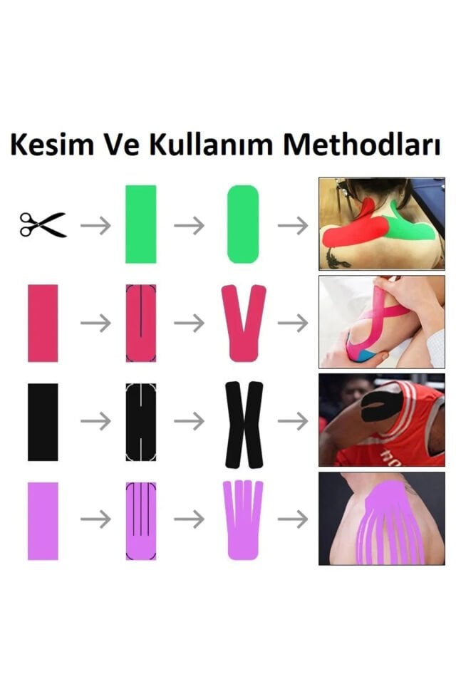 Acura Ac-150 Hipoalerjenik Kinesyo Tape Ağrı Bandı 5m X 5cm Kırmızı Renk